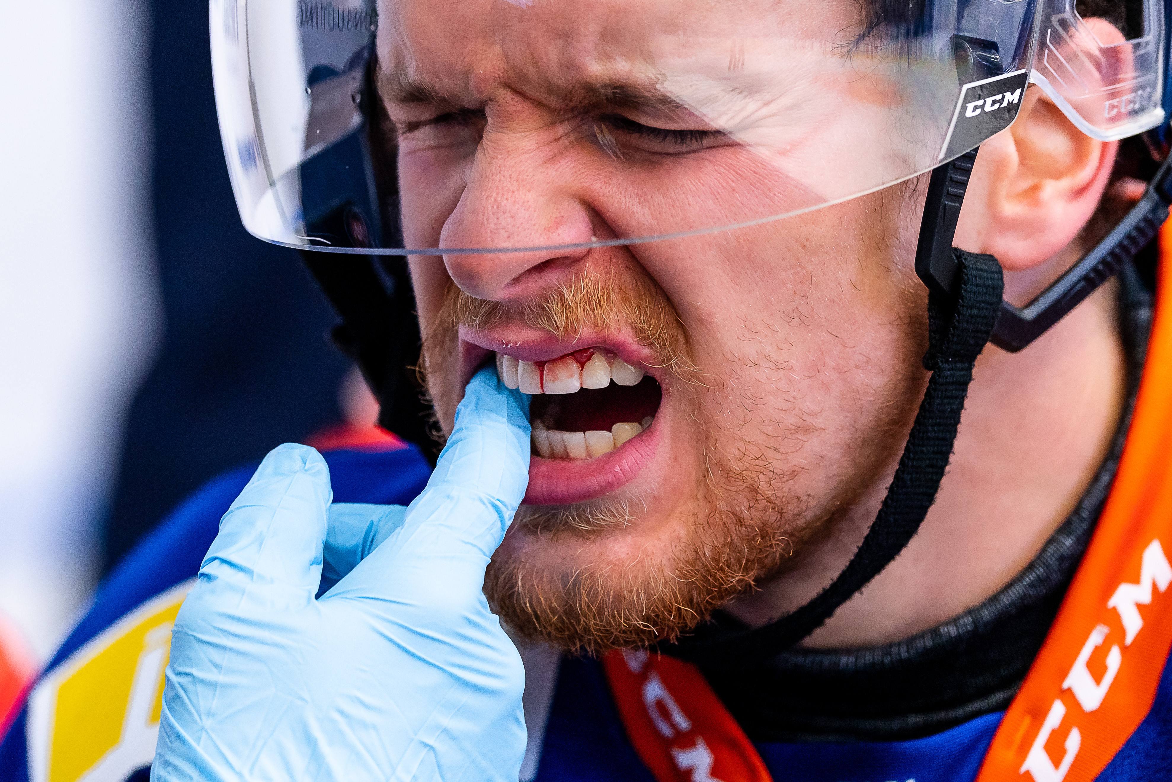 14 frågor inför SHL 2026/2027: Kan Linköping tämja Brendan Shinnimin?